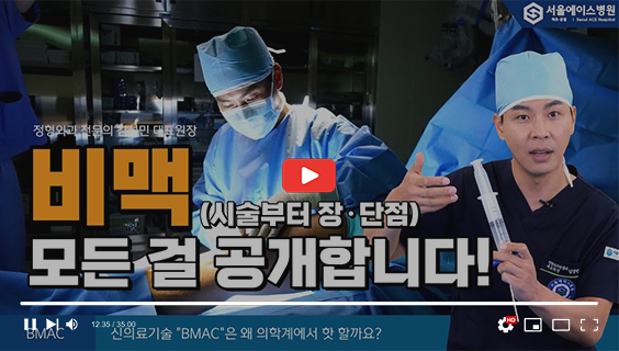 수술이 두려워 참아왔던 무릎 통증, BMAC으로 벗어나자! 치료 방법부터 치료 후 관리까지! [BMAC 2편]
