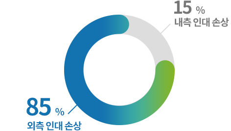 외측 인대 손상 85%, 내측 인대 손상 15% 도넛 그래프