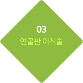 03 연골판 이식술