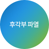 후각부 파열
