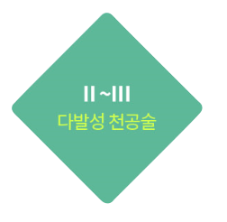 II~III기 다발성 천공술
