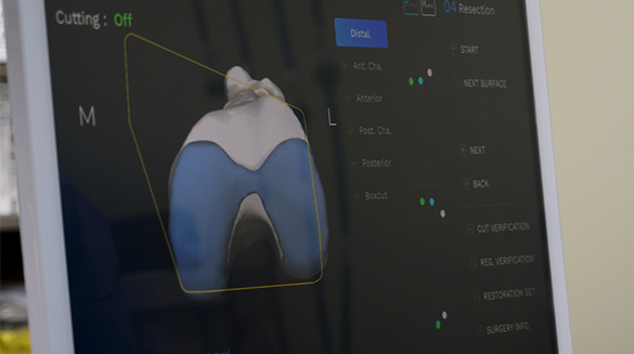 3D 맞춤 로봇인공관절수술