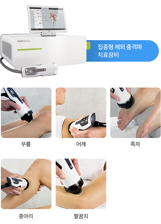 집중형 체외충격파 치료장비와 무릎, 어깨, 족저, 종아리, 팔꿈치 적용 부위