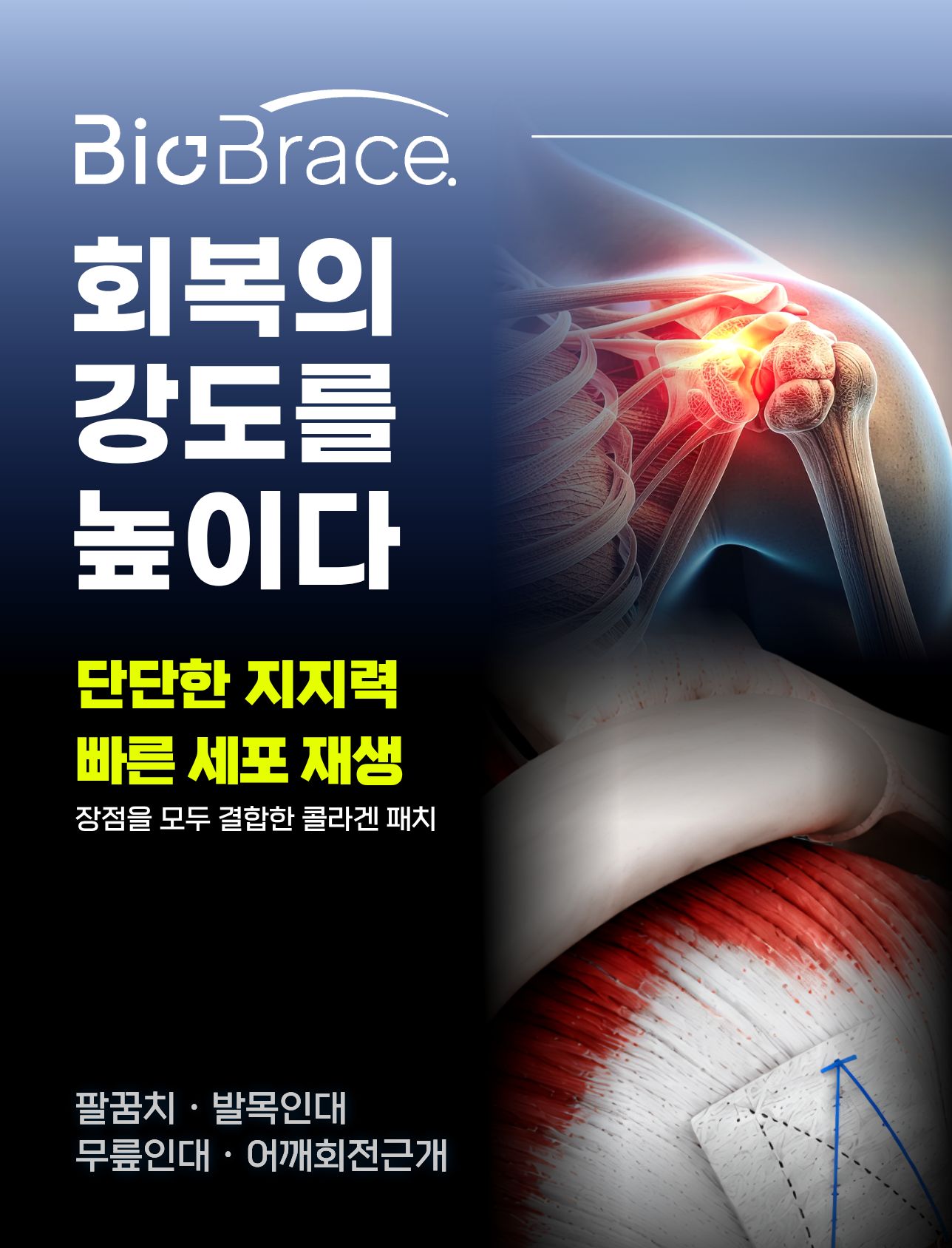 BioBrace 콜라겐 패치 안내: 팔꿈치·발목인대·무릎인대·어깨회전근개