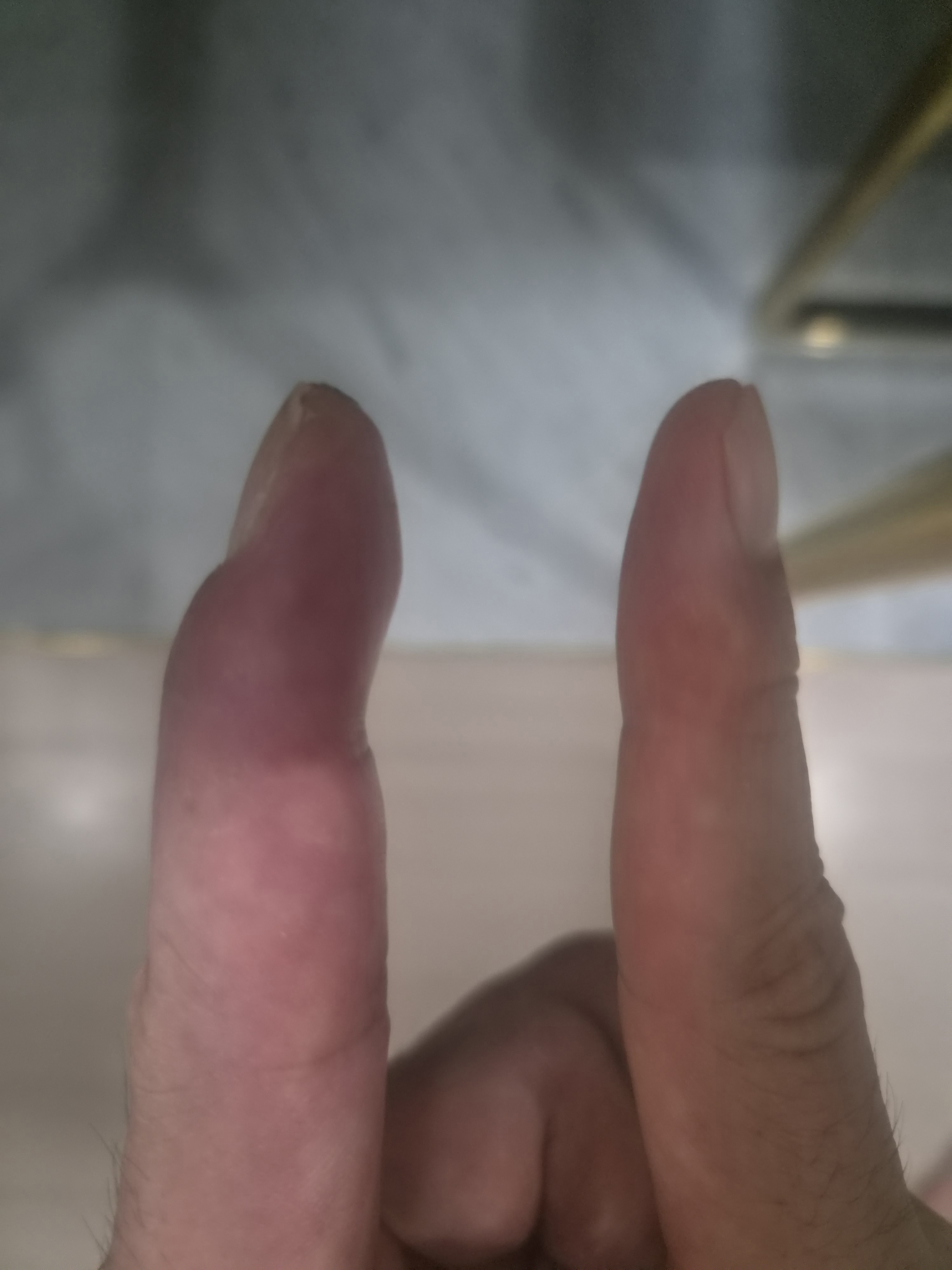 상담 첨부 이미지